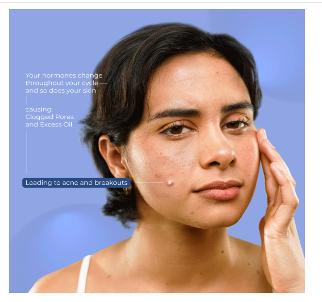 Pimple Patches – Hydrocolloid & Tea Tree Oil for Acne | GlowForm